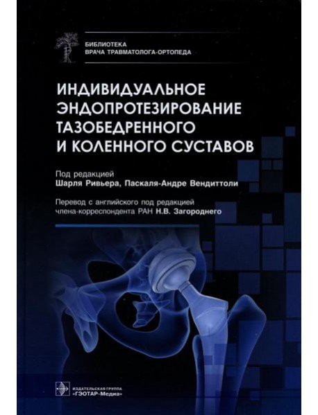 Индивидуальное эндопротезирование тазобедренного и коленного суставов