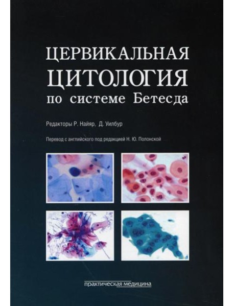 Цервикальная цитология по системе Бетесда. Терминология, критерии и пояснения