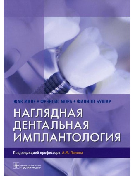 Наглядная дентальная имплантология