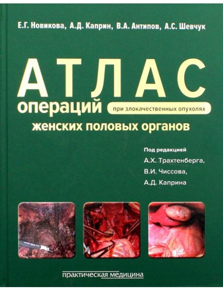 Атлас операций при злокачественных опухолях женских половых органов