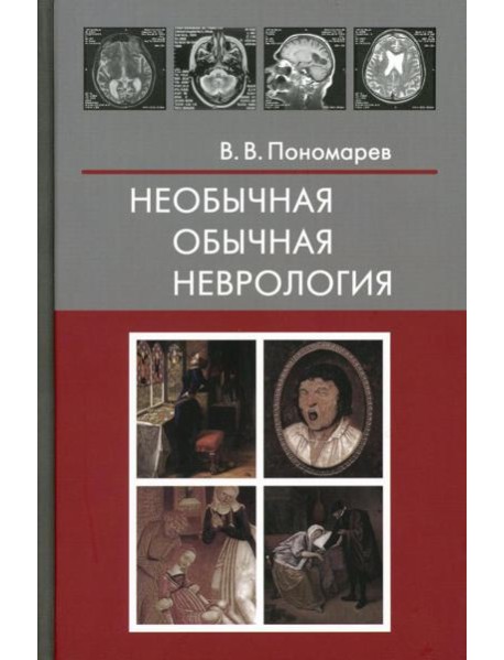 Необычная обычная неврология: руководство для врачей