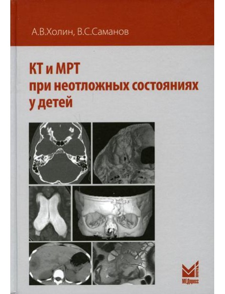 КТ и МРТ при неотложных состояниях у детей