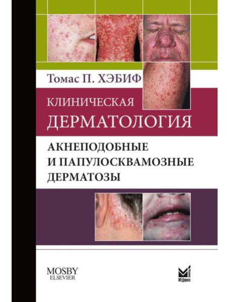 Клиническая дерматология. Акнеподобные и папулосквамозные дерматозы
