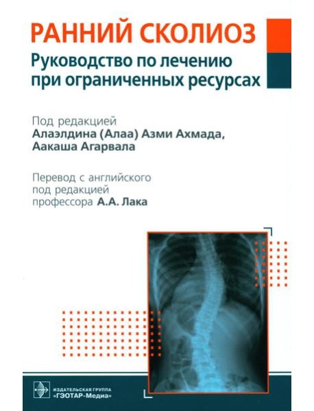 Ранний сколиоз. Руководство по лечению при ограниченных ресурсах