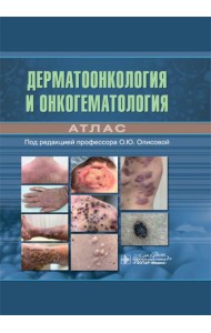Дерматоонкология и онкогематология. Атлас
