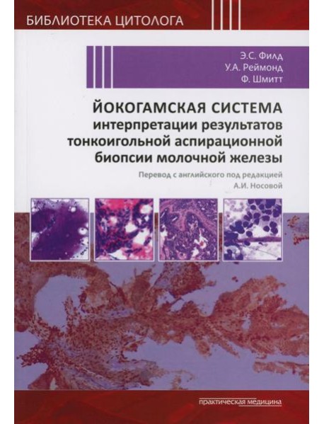 Йокогамская система интерпретации результатов тонкоигольной аспирационной биопсии молочной железы