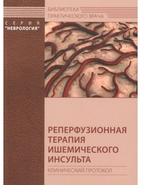Реперфузионная терапия ишемического инсульта. Клинический протокол