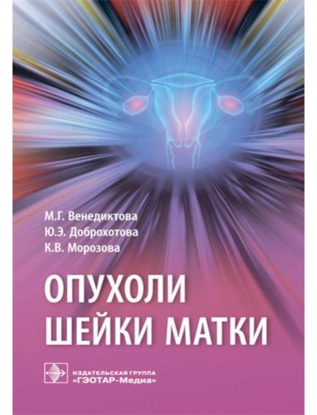 Опухоли шейки матки