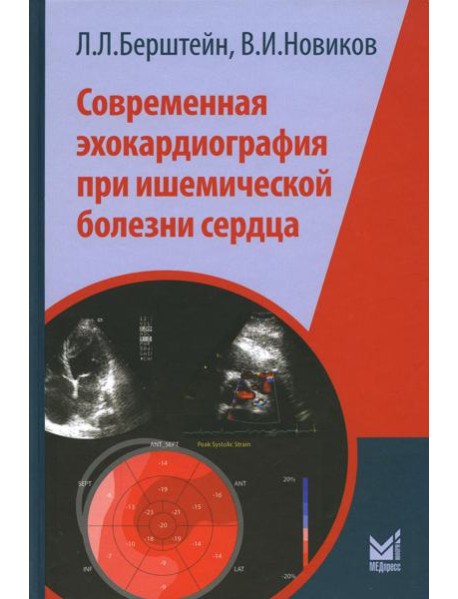 Современная эхокардиография при ишемической болезни сердца