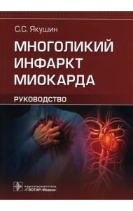Многоликий инфаркт миокарда. Руководство