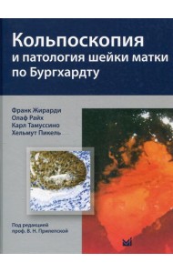 Кольпоскопия и патология шейки матки по Бургхардту