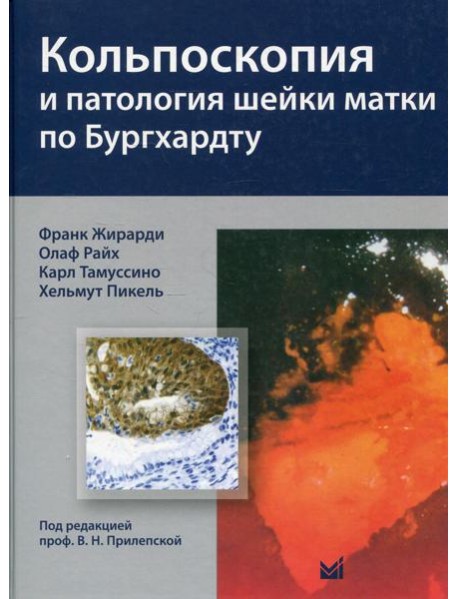 Кольпоскопия и патология шейки матки по Бургхардту