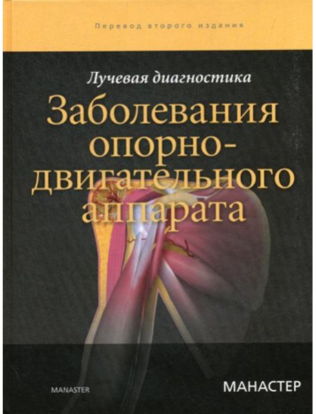 Лучевая диагностика. Заболевания опорно-двигательного аппарата. 2-е изд