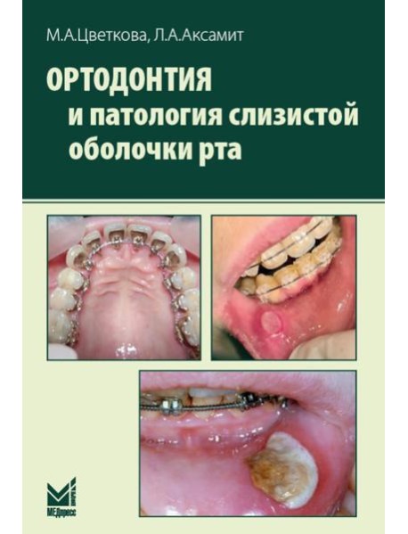 Ортодонтия и патология слизистой оболочки рта