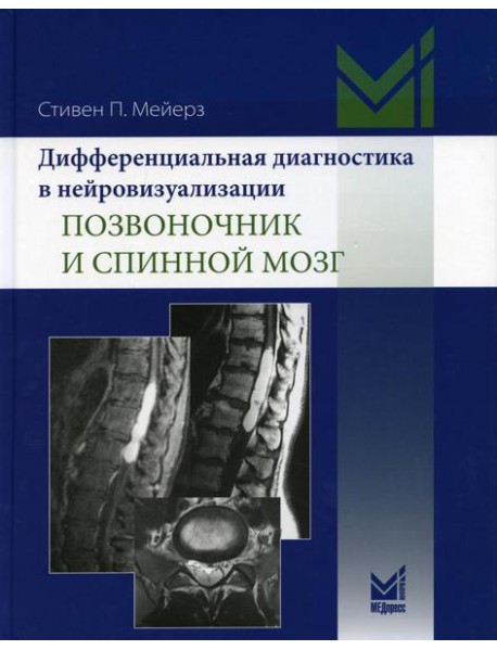Дифференциальная диагностика в нейровизуализации. Позвоночник и спинной мозг