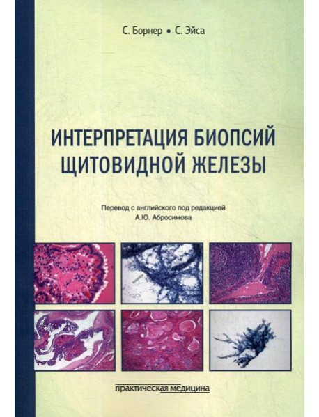 Интерпретация биопсий щитовидной железы