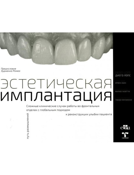 Эстетическая имплантация. Сложные клинические случаи работы во фронтальных отделах с глобальным подходом к реконструкции улыбки пациента
