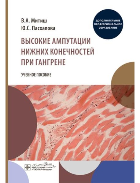 Высокие ампутации нижних конечностей при гангрене: Учебное пособие