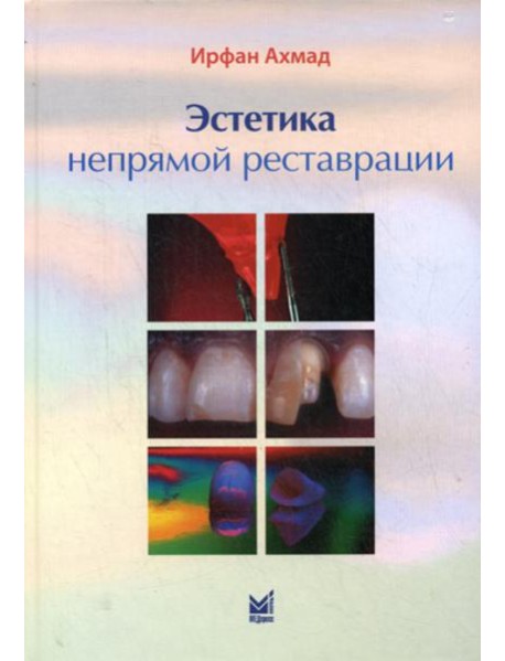 Эстетика непрямой реставрации