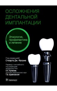 Осложнения дентальной имплантации. Этиология, профилактика и лечение