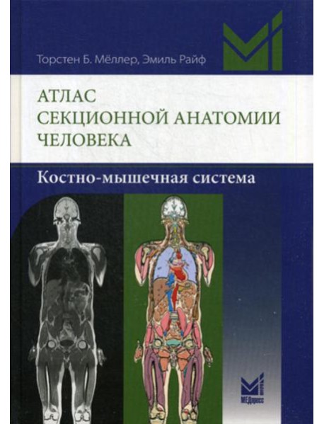 Атлас секционной анатомии человека. Костно-мышечная система