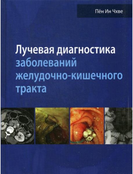 Лучевая диагностика заболеваний желудочно-кишечного тракта