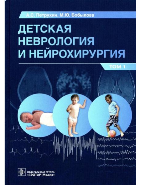 Детская неврология и нейрохирургия: Учебник. В 2 т. Т. 1