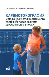 Кардиотокография - метод оценки функционального состояния плода во время беременности: Учебное пособие. 2-е изд