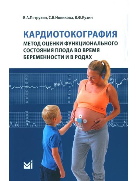 Кардиотокография - метод оценки функционального состояния плода во время беременности: Учебное пособие. 2-е изд