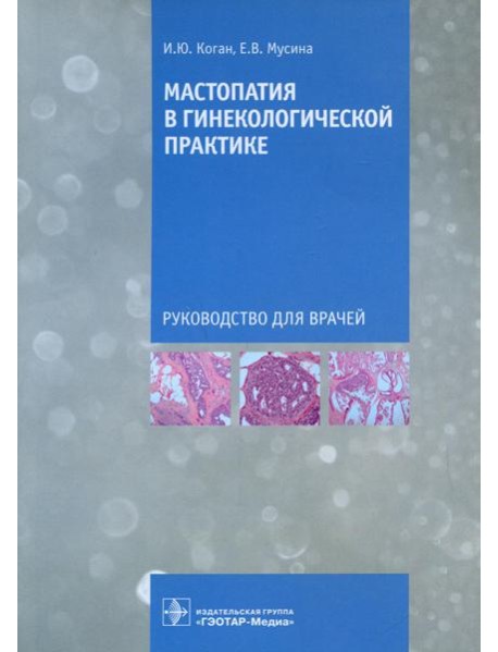Мастопатия в гинекологической практике: руководство для врачей