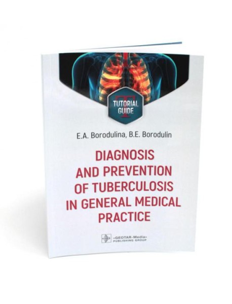 Diagnosis and prevention of tuberculosis in general medical practice: tutorial guide = Диагностика и профилактика туберкулеза в общей врачебной практи