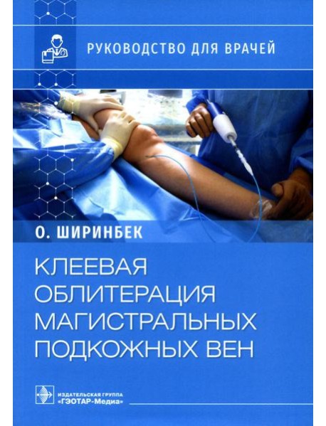 Клеевая облитерация магистральных подкожных вен: руководство для врачей
