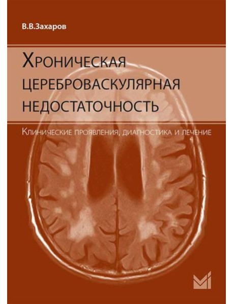 Хроническая цереброваскулярная недостаточность. 4-е изд., перераб.и доп