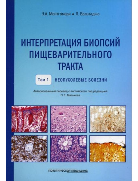 Интерпретация биопсий пищеварительного тракта. Т. 1: Неопухолевые болезни