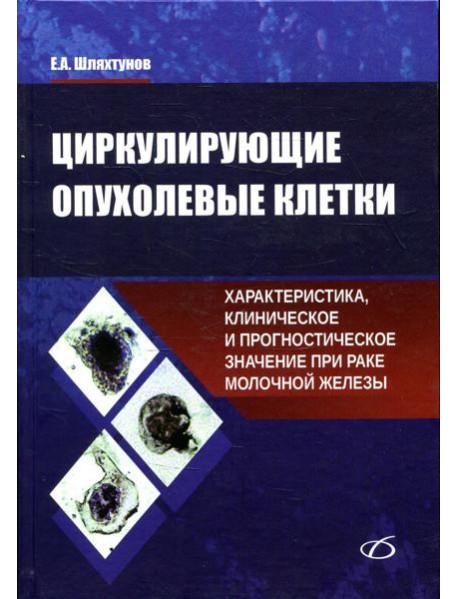 Циркулирующие опухолевые клетки: характеристика, клиническое и прогностическое значение при раке молочной железы
