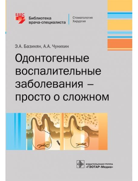 Одонтогенные воспалительные заболевания - просто о сложном