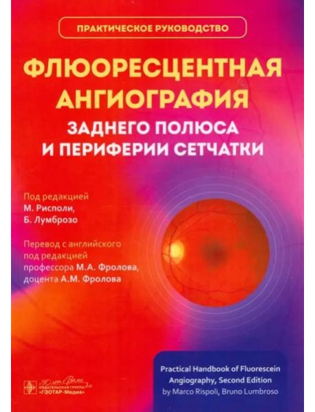 Флюоресцентная ангиография заднего полюса и периферии сетчатки