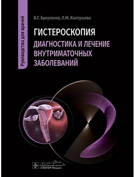 Гистероскопия. Диагностика и лечение внутриматочных заболеваний: руководство для врачей