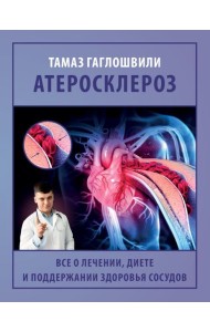 Атеросклероз. Все о лечении, диете и поддержании здоровья сосудов