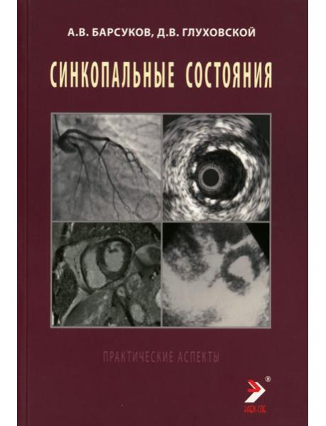 Синкопальные состояния: практические аспекты