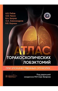 Атлас торакоскопических лобэктомий при злокачественных опухолях