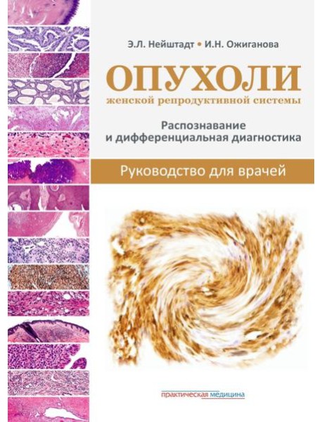 Опухоли женской репродуктивной системы. Распознавание и дифференциальная диагностика. Руководство для врачей