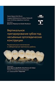 Вертикальное препарирование зубов под несъемные ортопедические конструкции