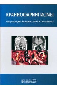 Краниофарингиомы