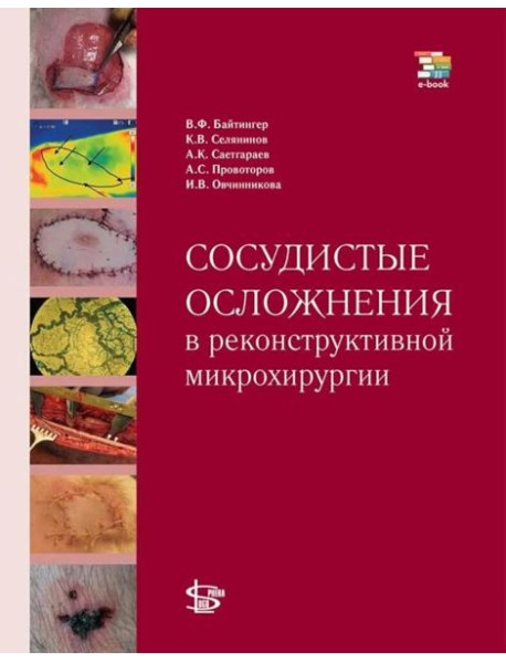 Сосудистые осложнения в реконструктивной микрохирургии