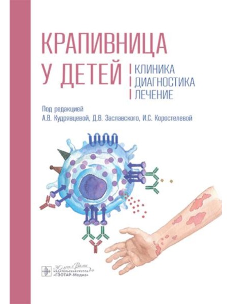 Крапивница у детей: клиника, диагностика, лечение