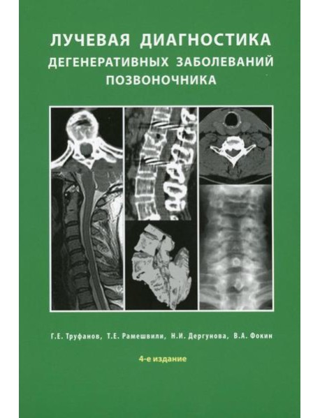 Лучевая диагностика дегенеративных заболеваний позвоночника