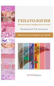 Гепатология. Клиническая морфология печени. Практическое руководство для врачей