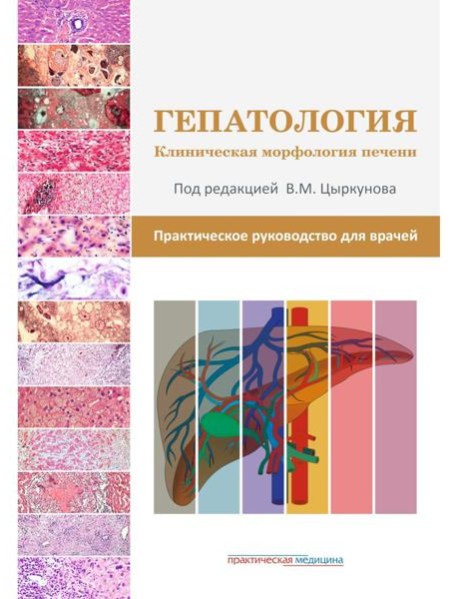 Гепатология. Клиническая морфология печени. Практическое руководство для врачей