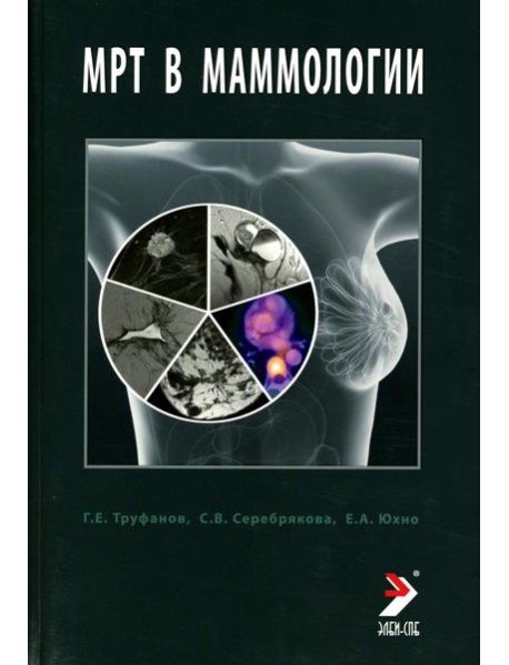 МРТ в маммологии: руководство для врачей